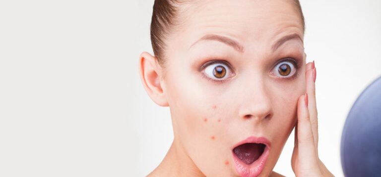 What causes Heat Boils & its cure