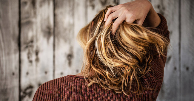 PCOS and Hair Loss – By Dr.Mini Nair