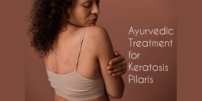 Ayurvedic Solutions for Keratosis Pilaris: Causes & Symptoms
