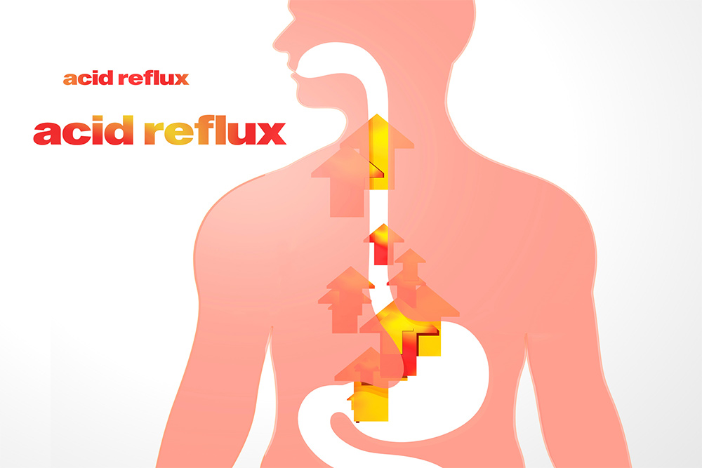 Ayurvedic-Treatment-for-Acid-Reflux-Natural-Relief-for-Acidity-GERD