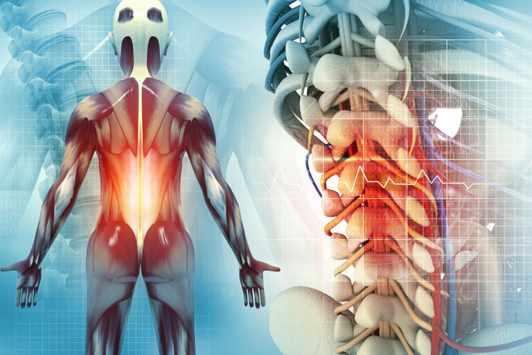 Ayurvedic Treatment for Spondylitis in Bangalore: Healing the Spine Naturally with Ayurhealing