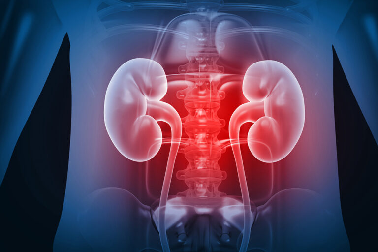 Ayurvedic Treatment for Kidney Health: Natural Healing with Ayurhealing Bangalore