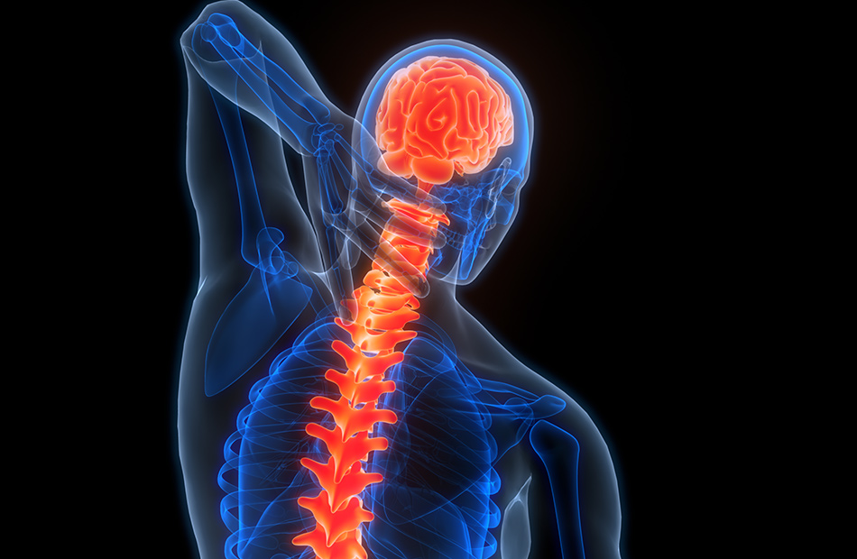 Cervical Spondylitis