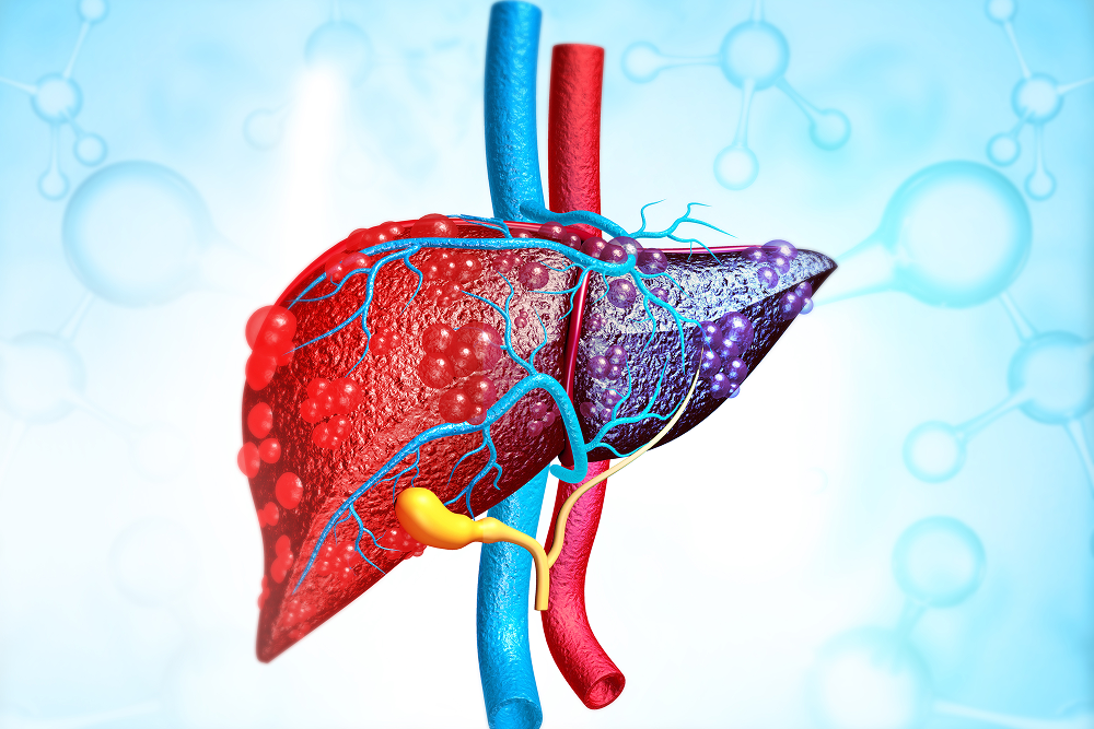 Ayurvedic-Treatment-for-Liver-Disorders-in-Bangalore-Heal-Your-Liver-Naturally