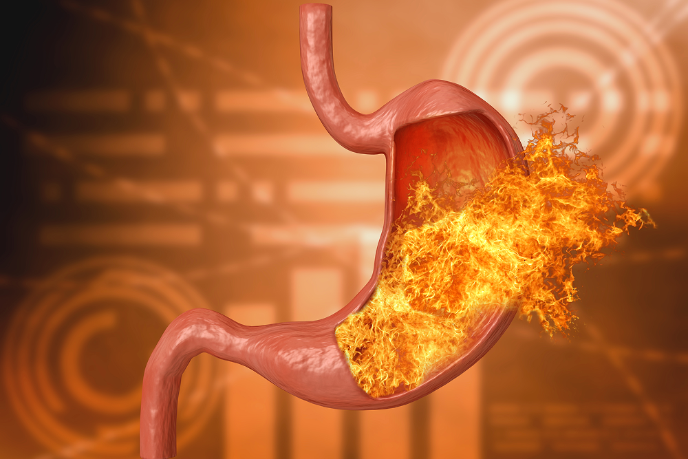 Acidity-Treatment-with-Ayurveda