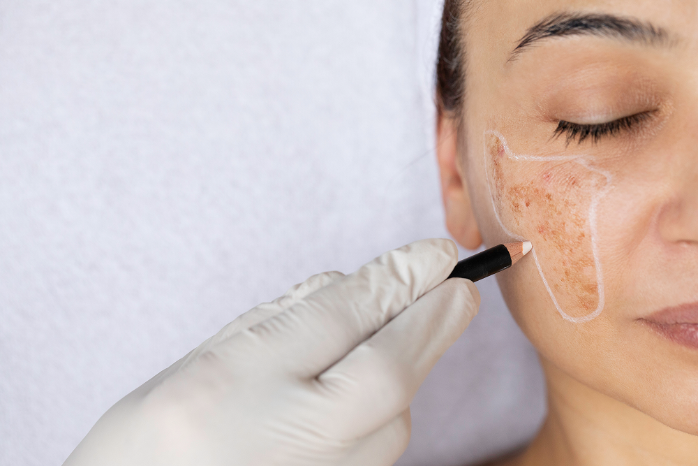Ayurvedic Treatment for Skin Whitening Herbs, Benefits & Skin Care Tips